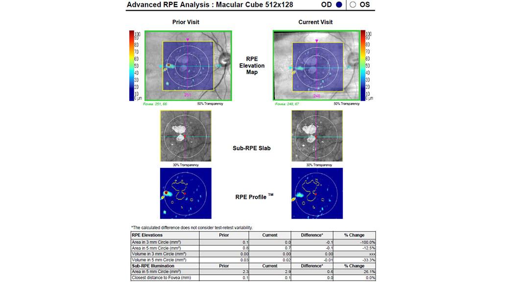 Un informe de Advanced RPE Analysis