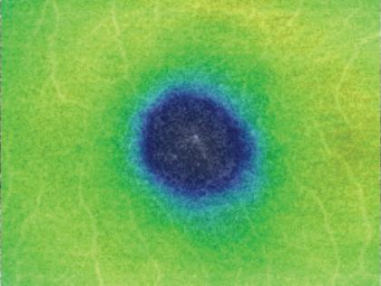 Diabetic Retinopathy (DR)