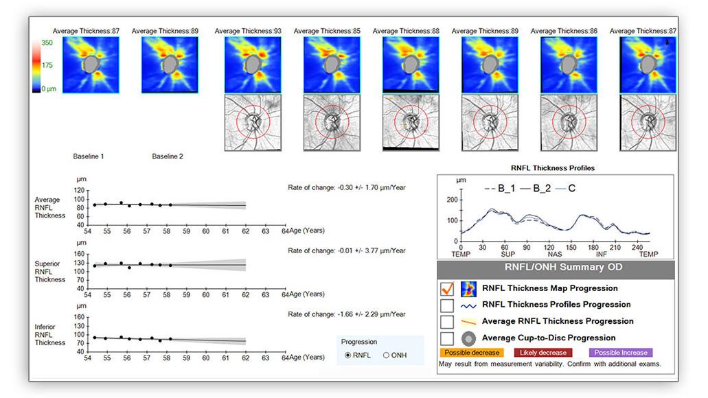 Image of Guided progression analysis
