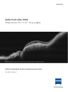 Pré-visualizar imagem de PLEX Elite 9000 Swept-Source OCT & OCT Angiography