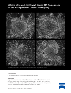 Pré-visualizar imagem de Case study