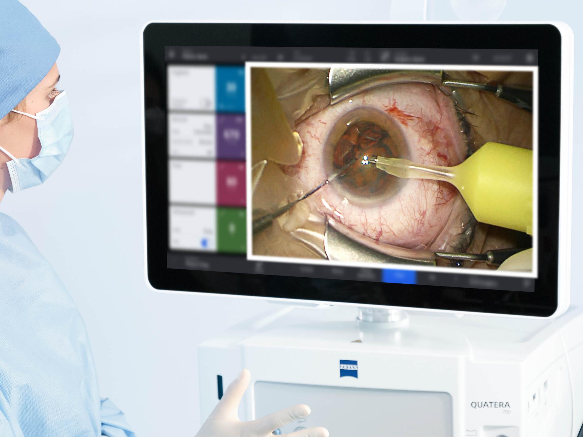 Illustration of a Digitally integrated surgical workflow