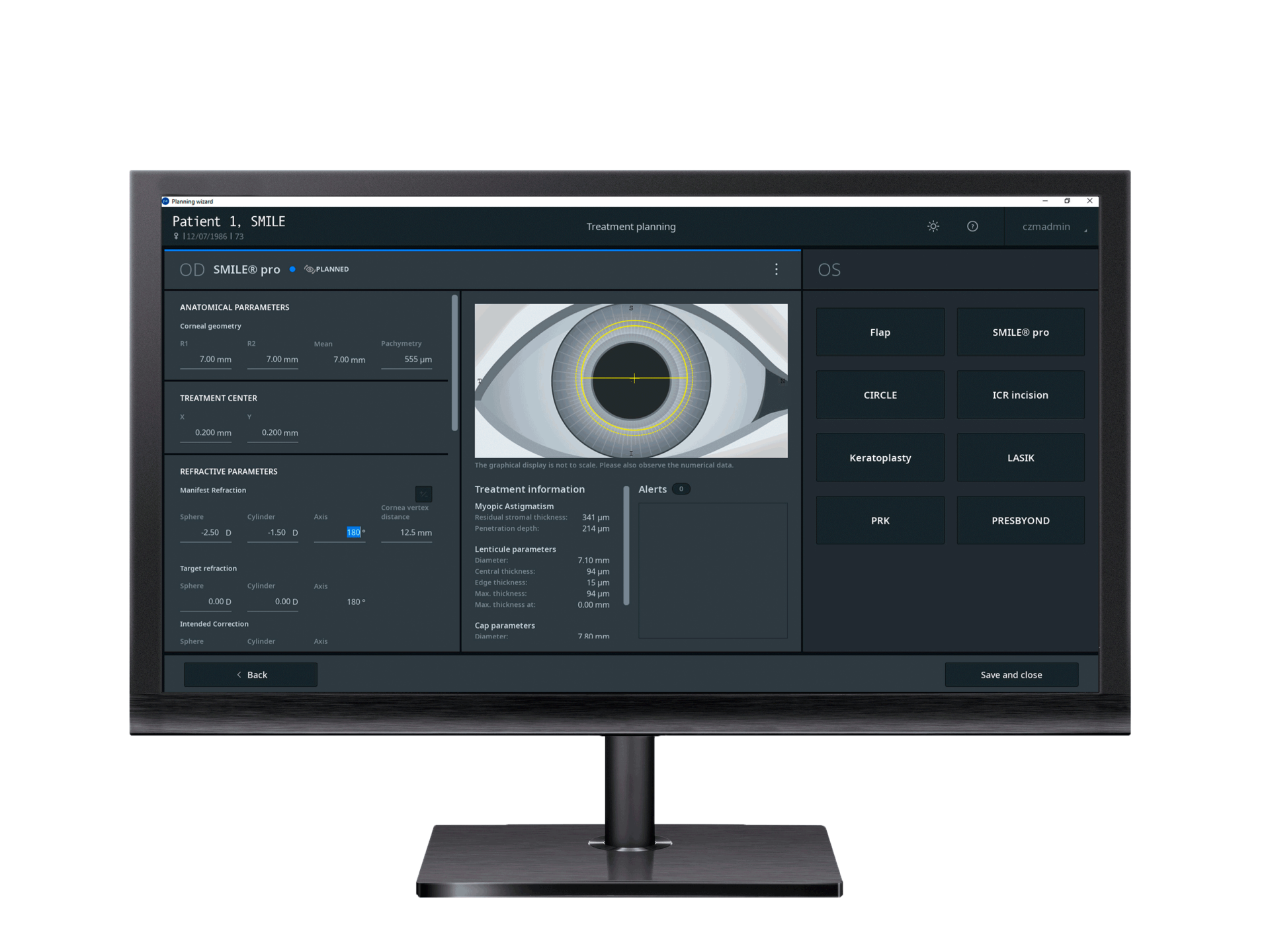  ZEISS Refractive Workplace