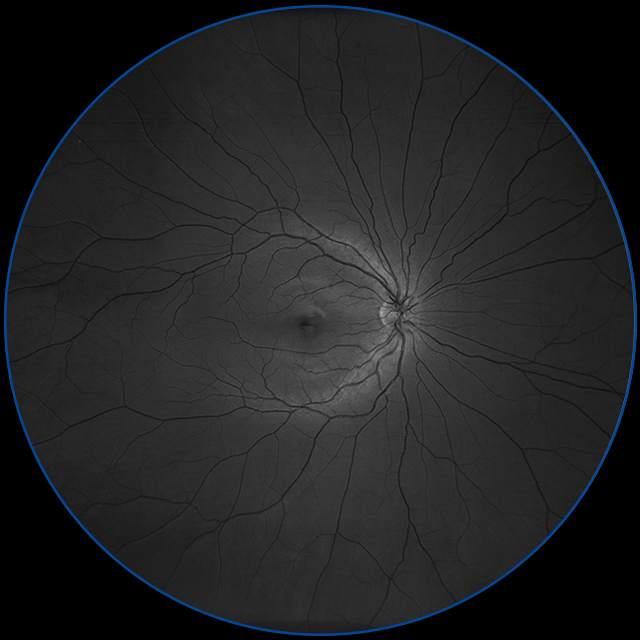 ZEISS CLARUS 500 — Разбор снимка на красный, зелёный и синий