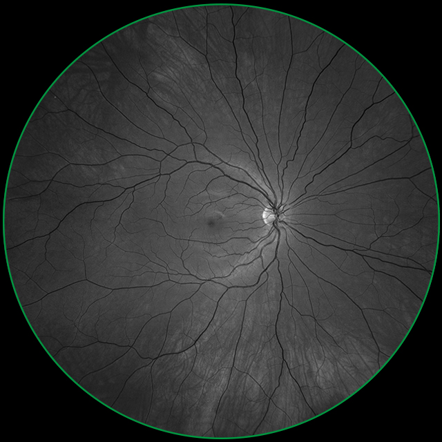 ZEISS CLARUS 500 — Разбор снимка на красный, зелёный и синий