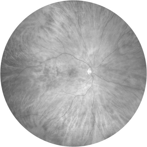 ZEISS CLARUS 500 — Разбор снимка на красный, зелёный и синий