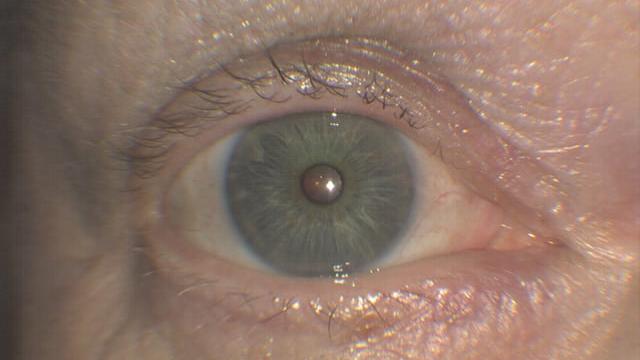 Healthy external eye image