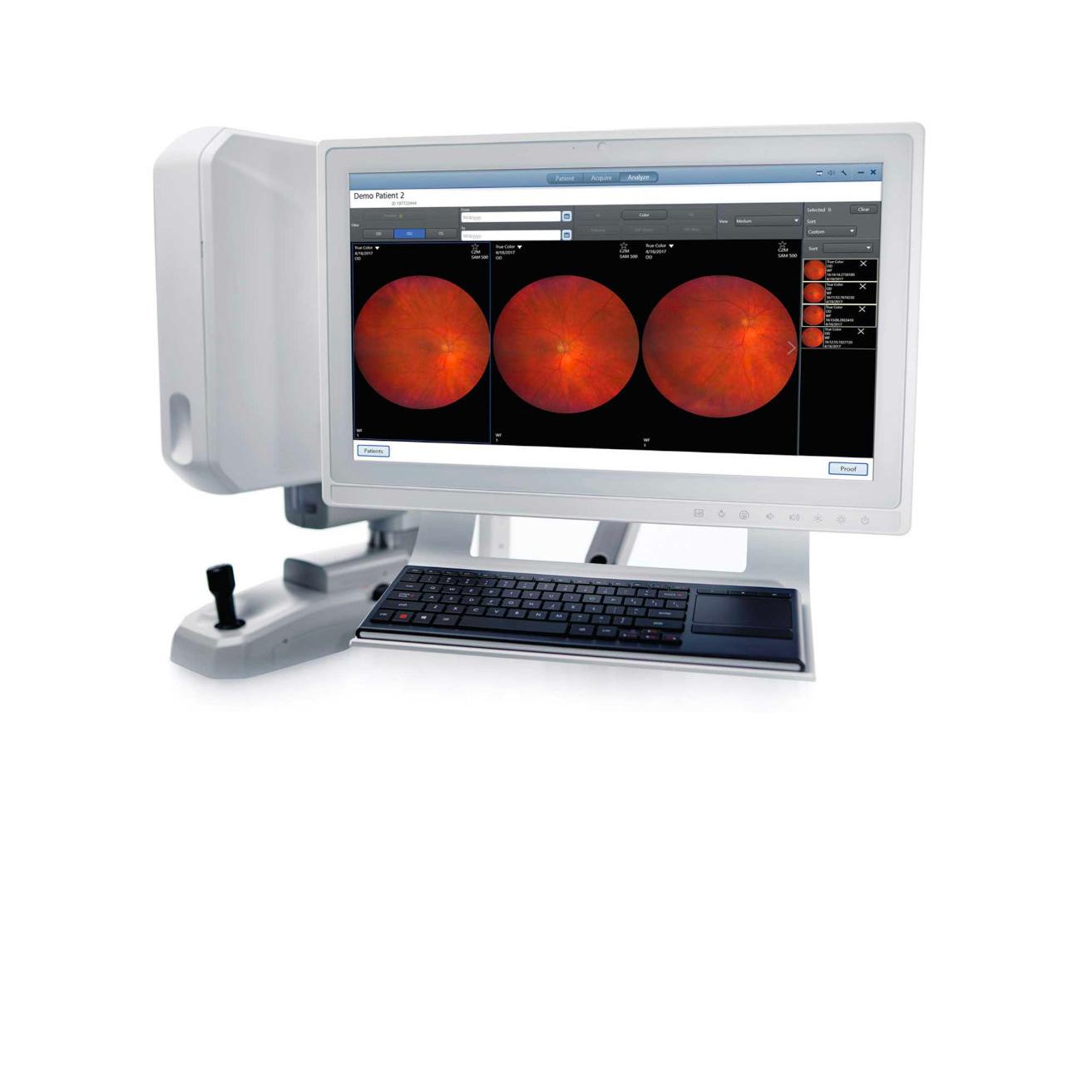 Innovaciones en retinógrafos de ZEISS