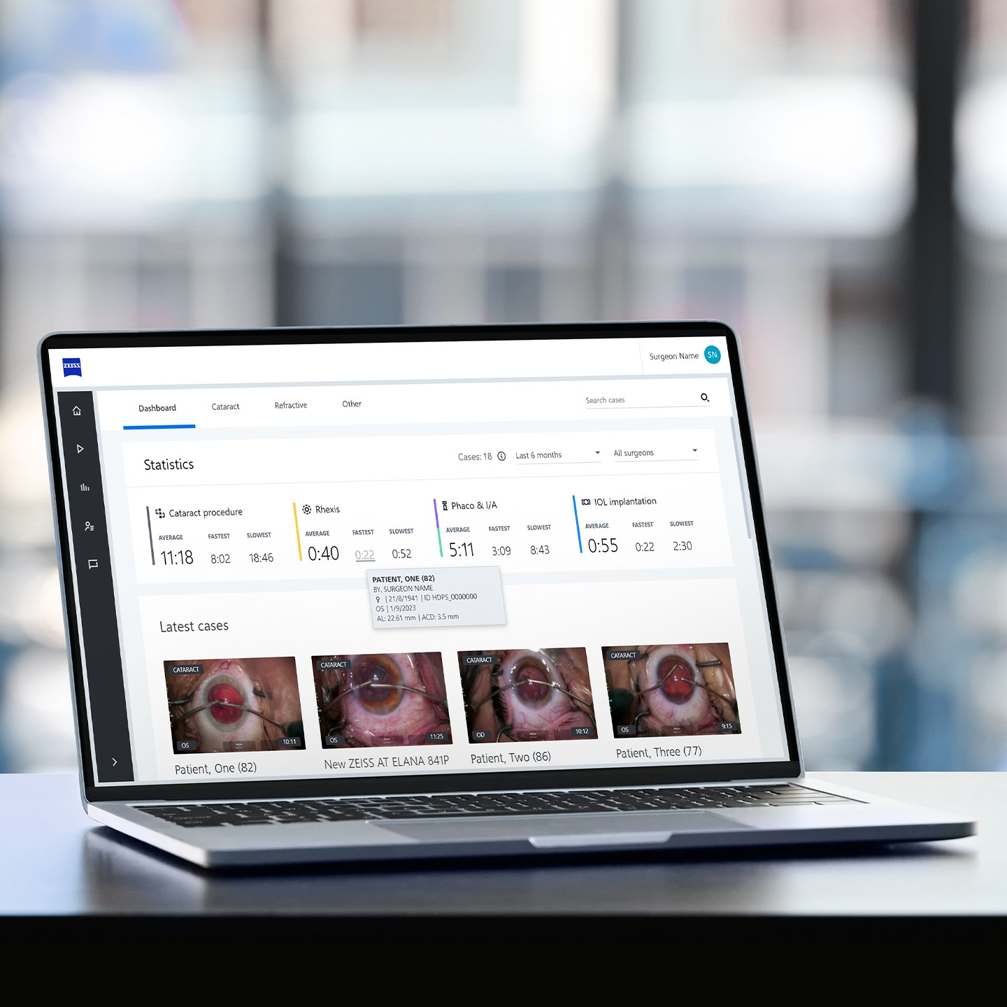 Ilustração do ZEISS Surgery Optimizer: Acesso fácil aos seus casos