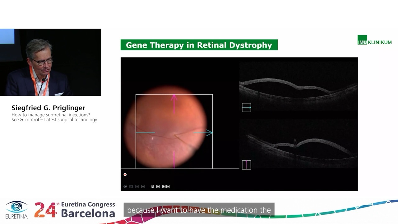 Slide showcasing advancements in gene therapy for retinal dystrophy, presented at the 24th Euretina Congress in Barcelona. The visual highlights a surgical procedure labeled 'Local ILM Peeling' with close-up imagery of the retina. Visible text includes 'Siegfried G. Priglinger' and '24th Euretina Congress Barcelona'. The presentation emphasizes cutting-edge techniques in ophthalmology.