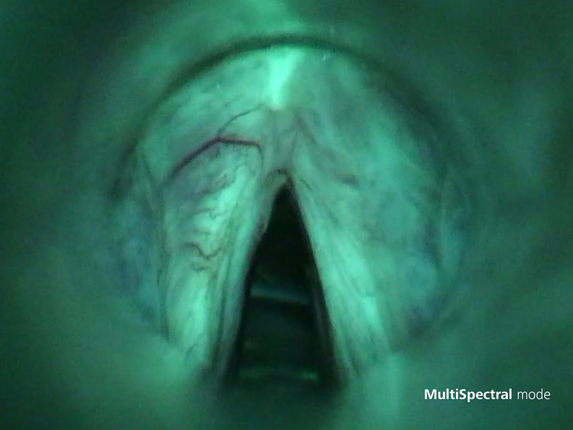 Microscope application standard mode