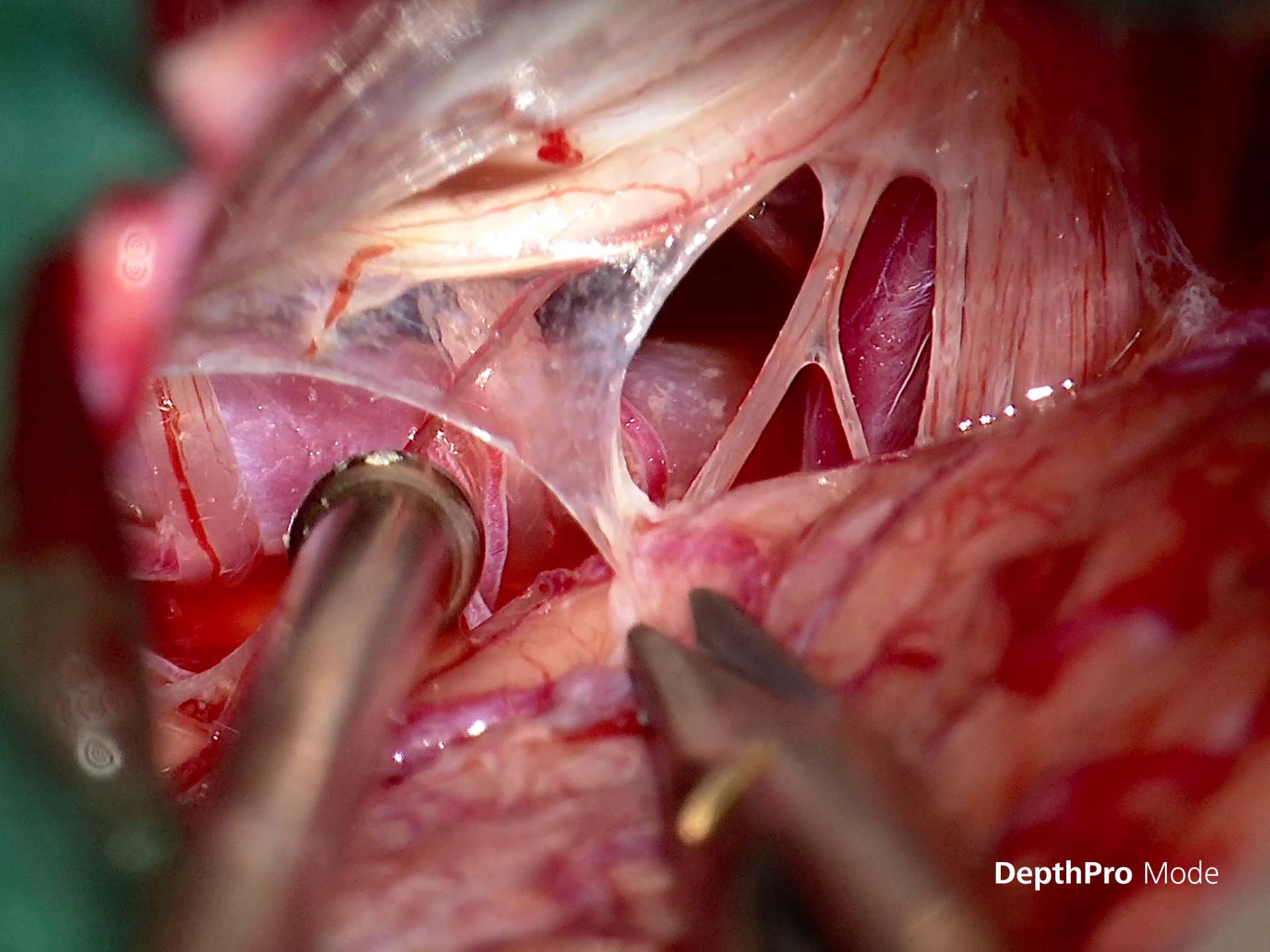 Depth pro in clinical use
