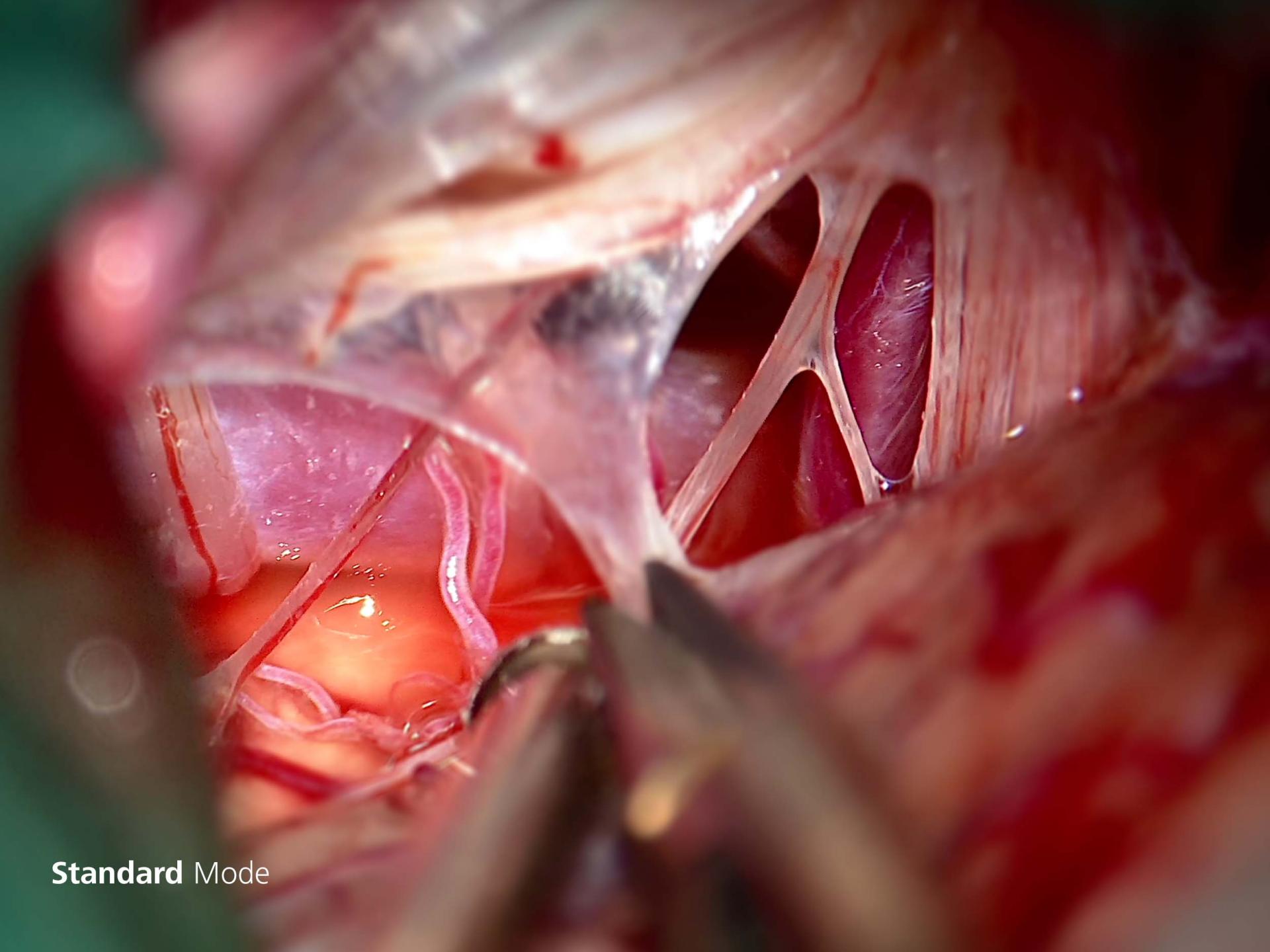Depth pro in clinical use