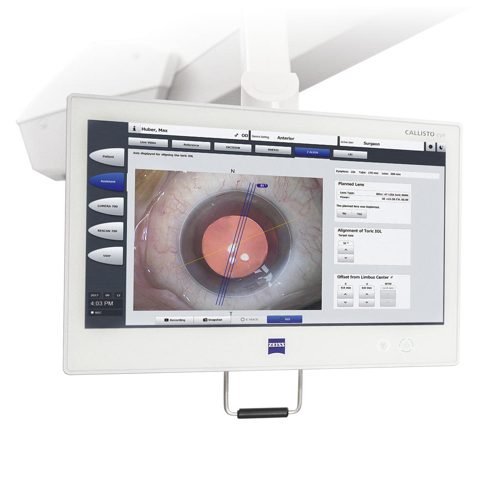 ZEISS OPMI Lumera i — CALLISTO eye: торическая ИОЛ без маркера