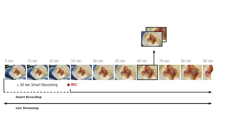 Vantagens da transmissão e visualização em direto