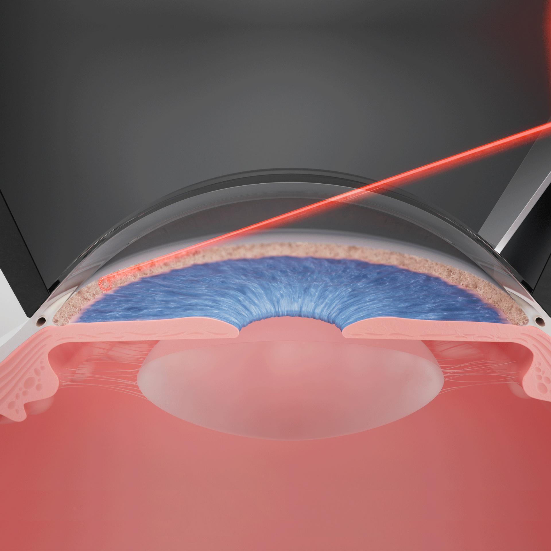 Rotierender Zielstrahl für einen uneingeschränkten Blick auf das Trabekelwerk