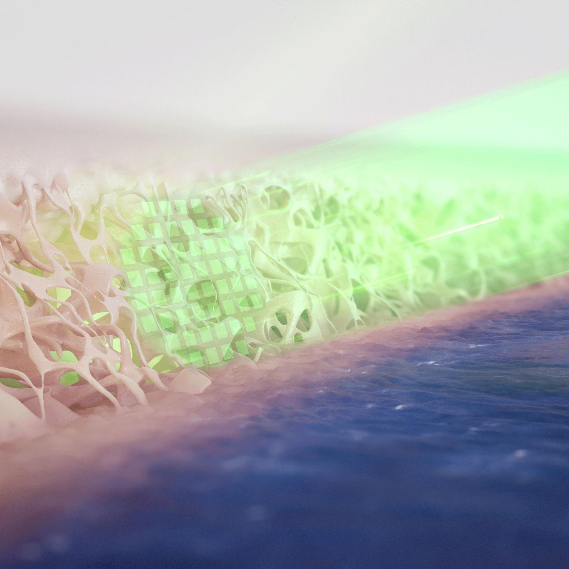 Homogenere Verteilung der Laserenergie dank 52 quadratischer Spots