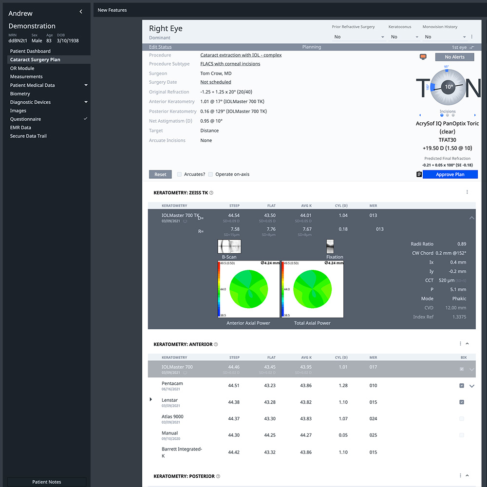 Screenshot of ZEISS VERACITY Surgery Planner