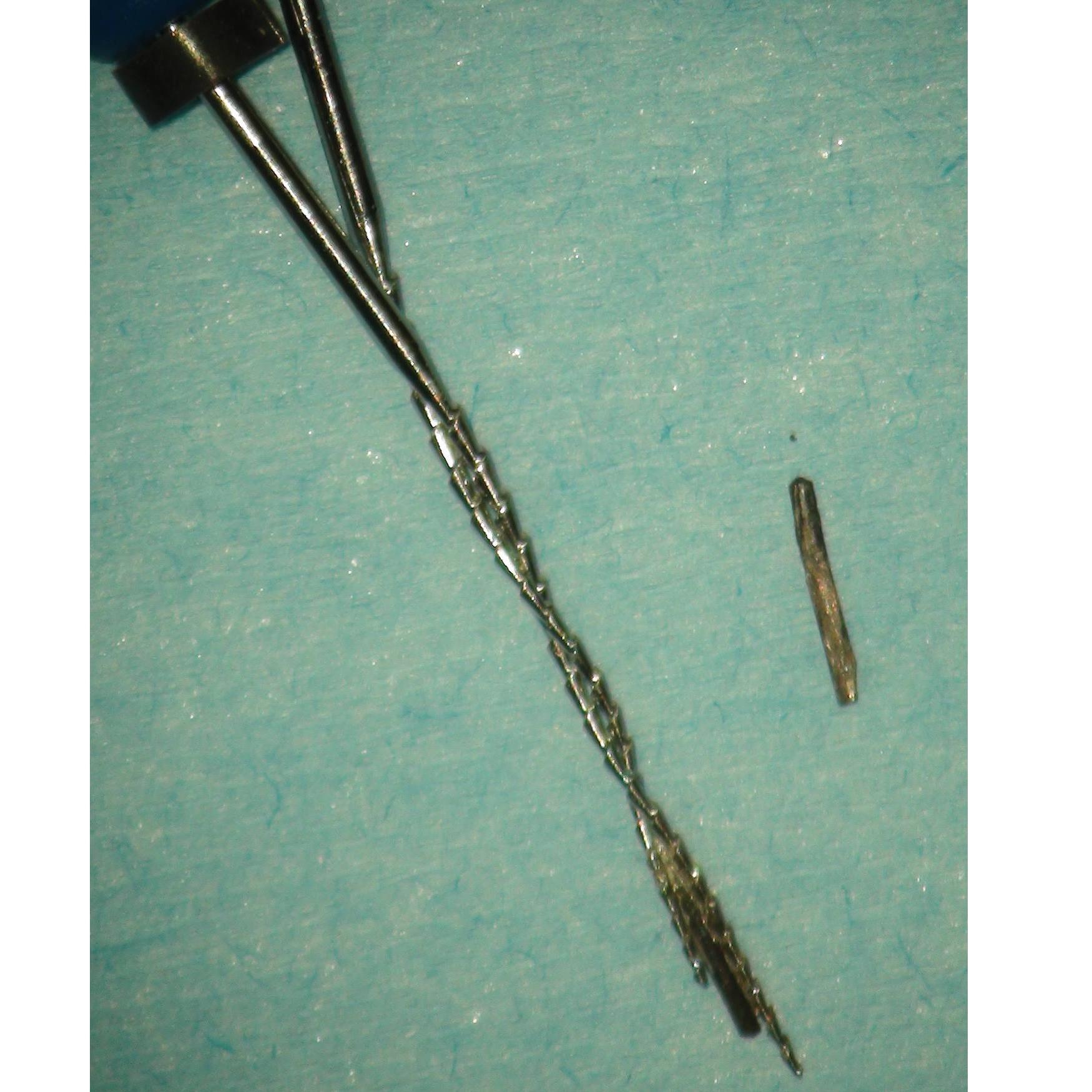 The OPMI was used to position and engage two Hedstrom files around the silver points
