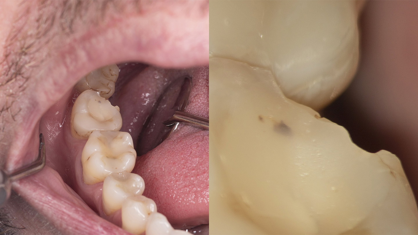 Diagnosis without magnification (left) and with high magnification (right)