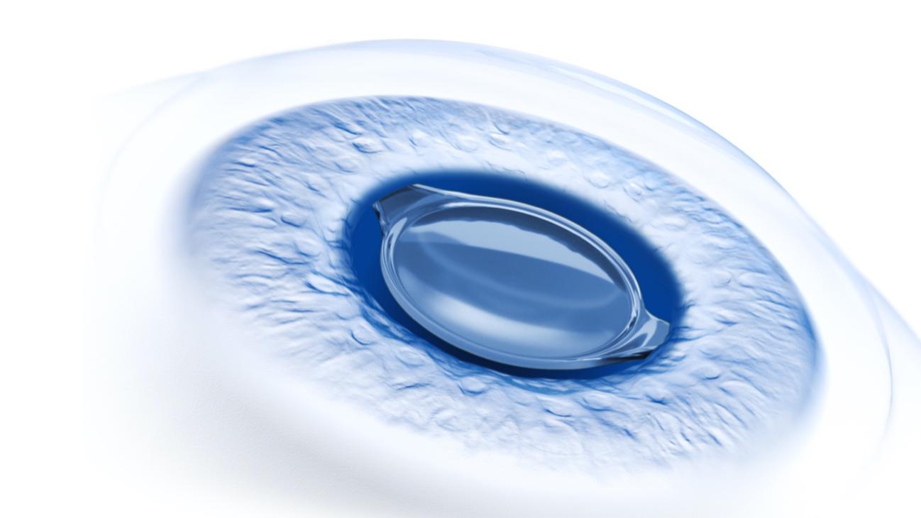 ZEISS Cataract Worklow
