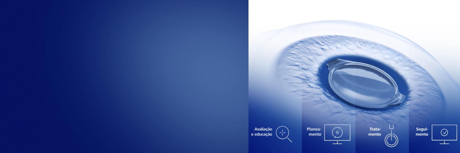 ZEISS Premium Cataract Workflow