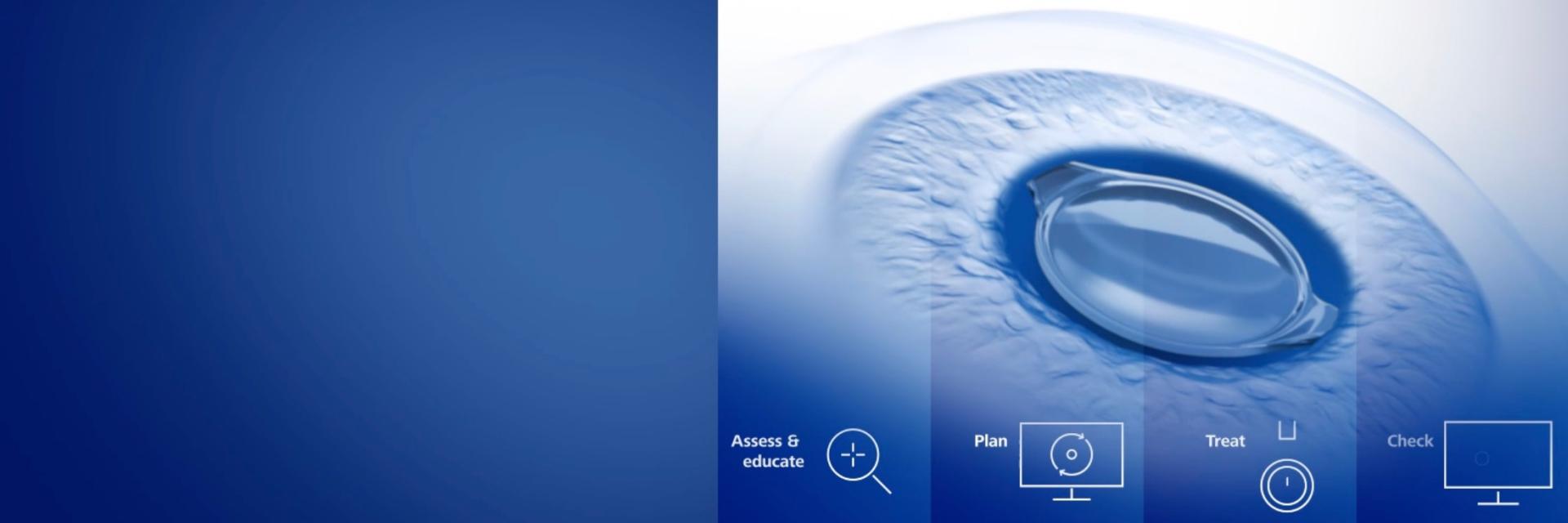 ZEISS Premium Cataract Workflow
