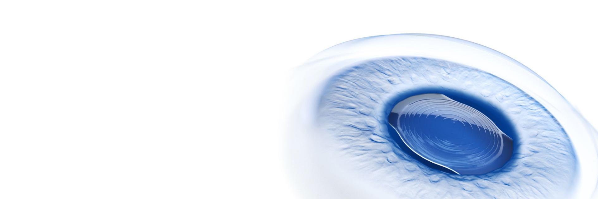 ZEISS Premium Cataract Workflow