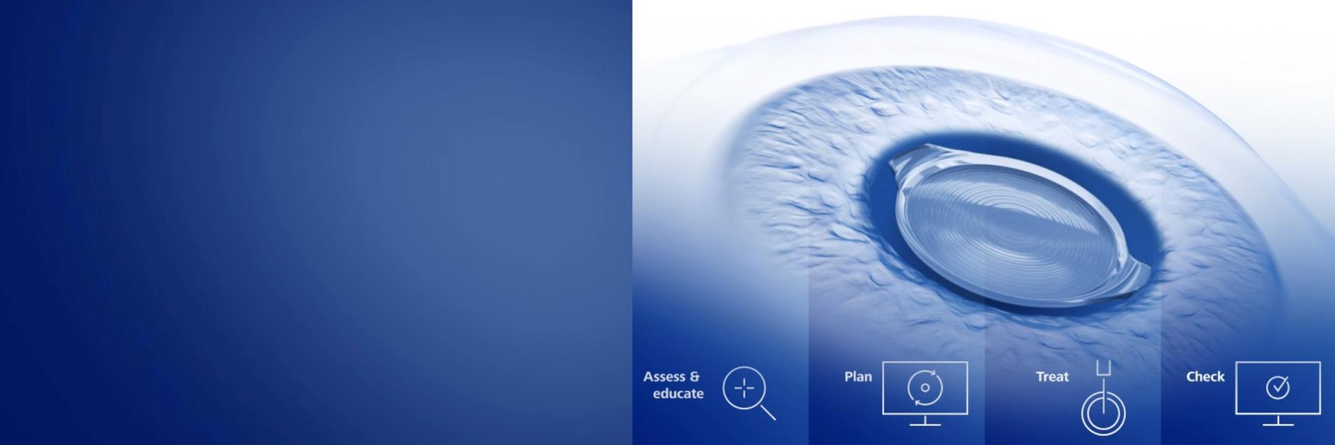 ZEISS Premium Cataract Workflow