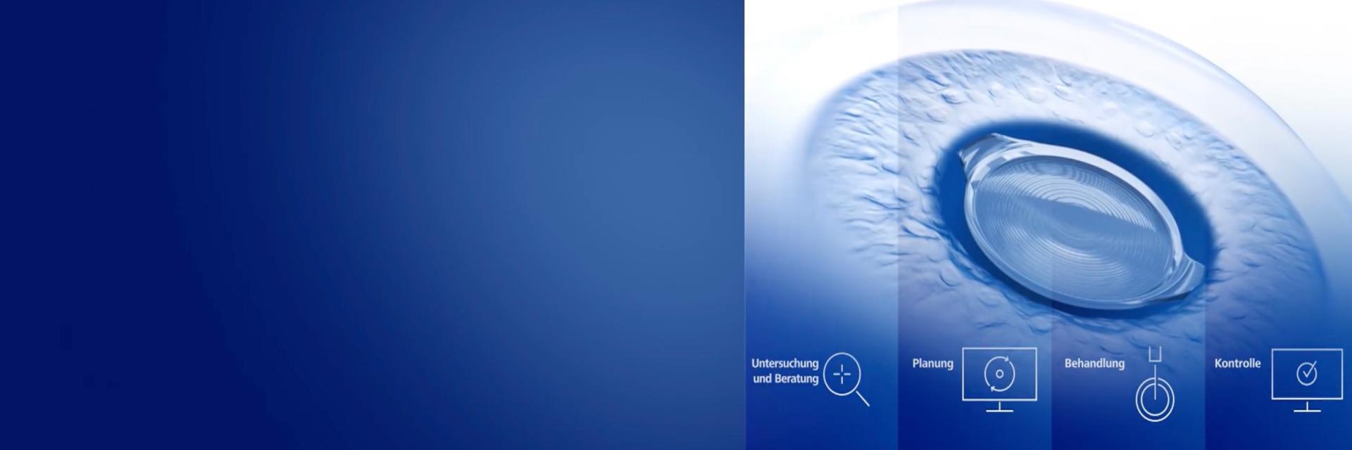 ZEISS Premium Cataract Workflow