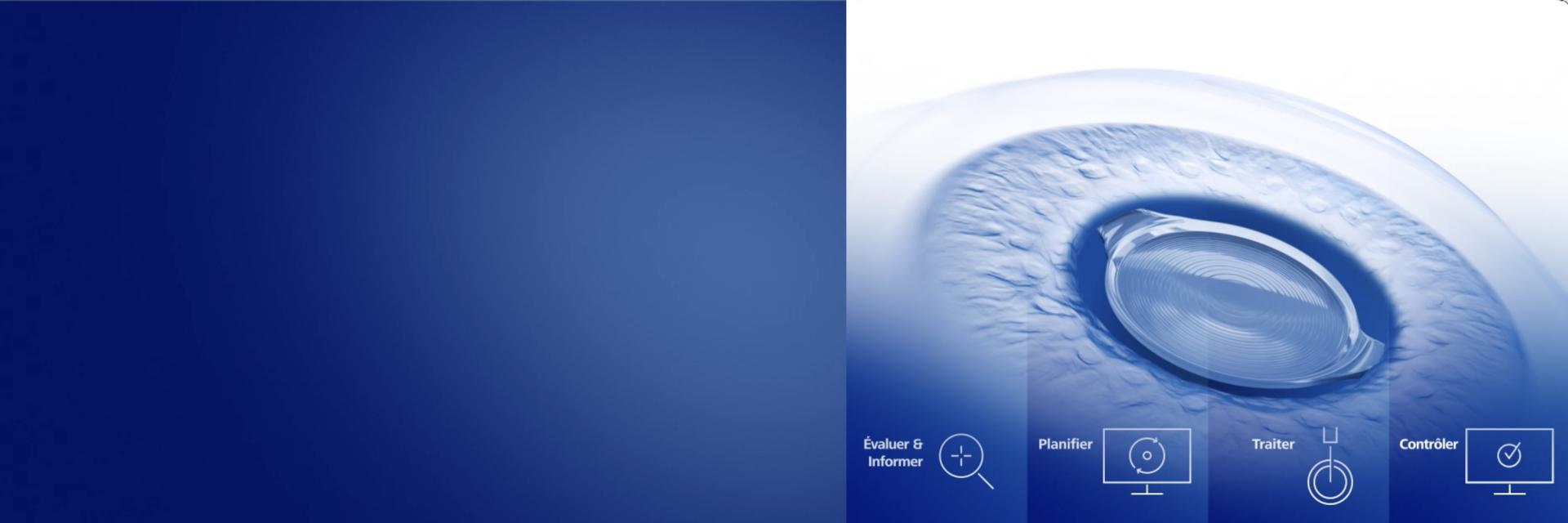ZEISS Premium Cataract Workflow