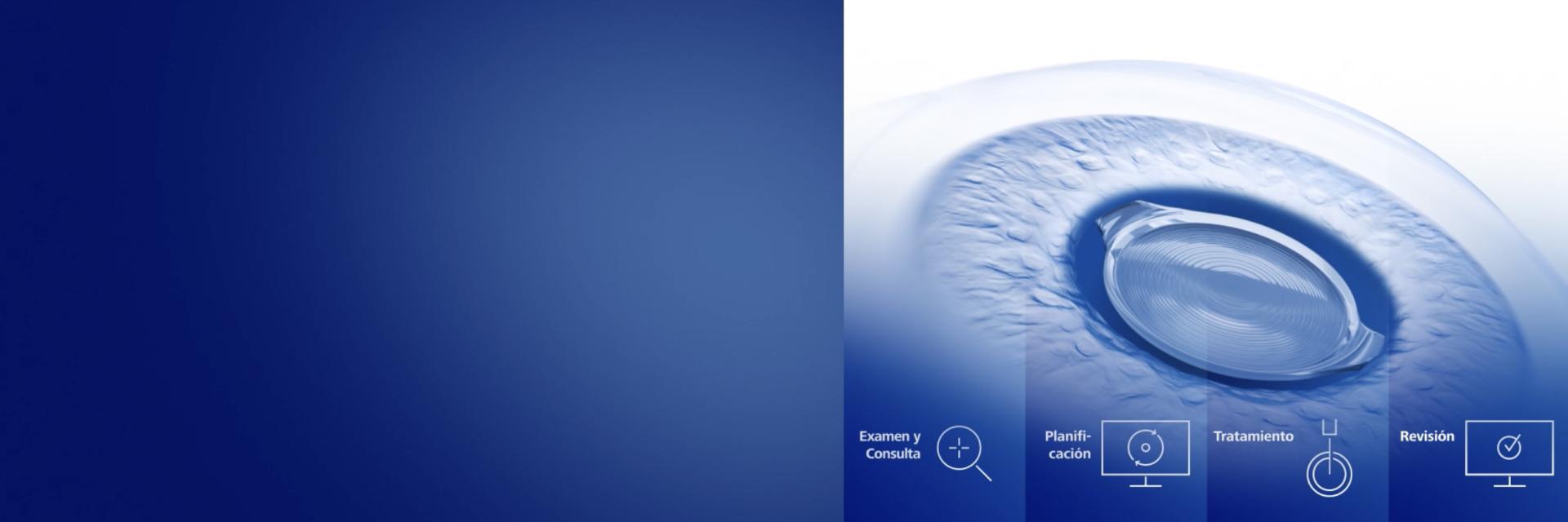 ZEISS Premium Cataract Workflow