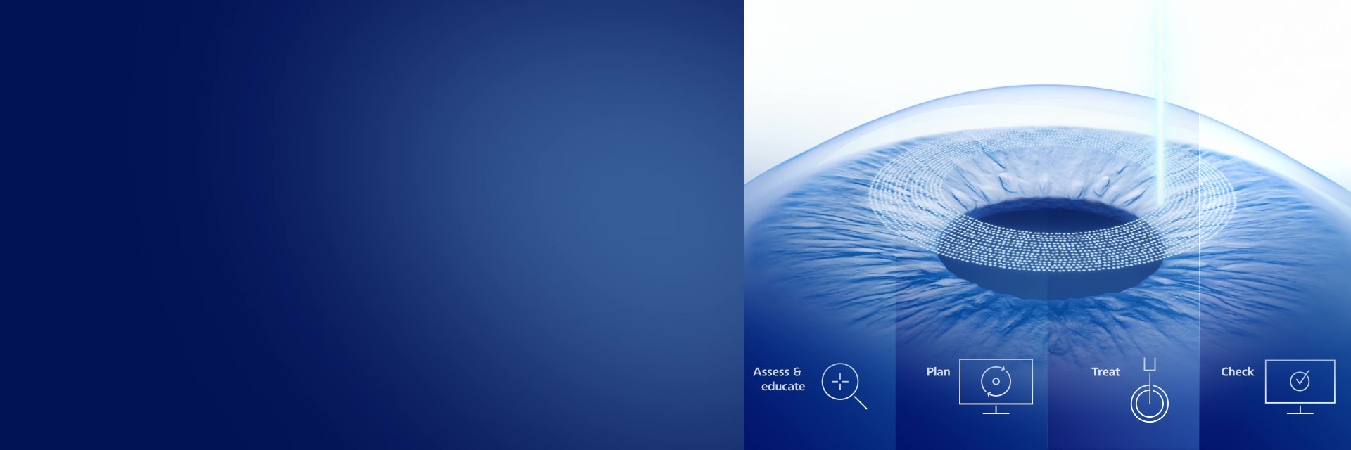 ZEISS Corneal Refractive Workflow
