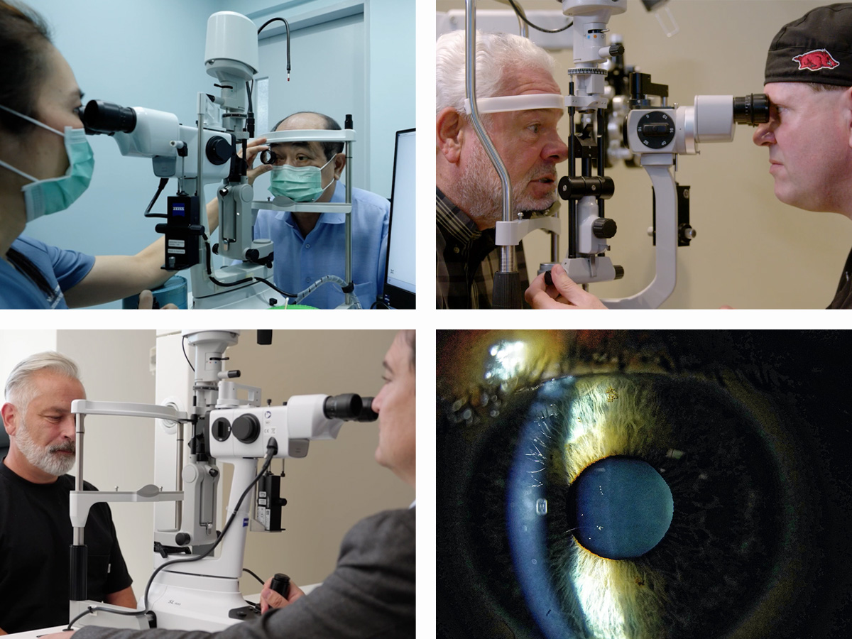 Four images showing eye examinations using slit lamps and close-up eye imaging performed by healthcare professionals.