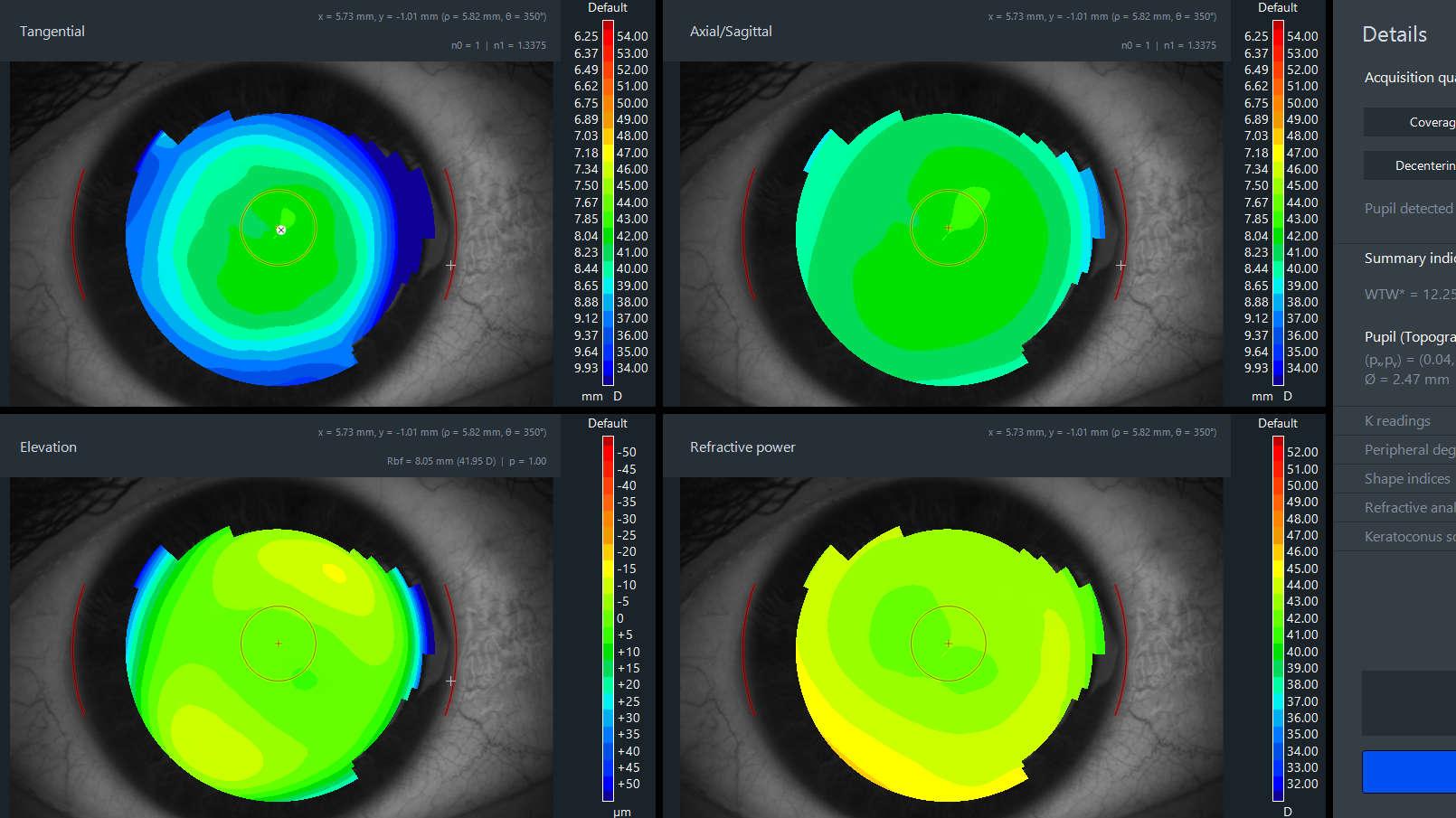 Immagine della Gestione della presbiopia di ZEISS: Visita e consultazione