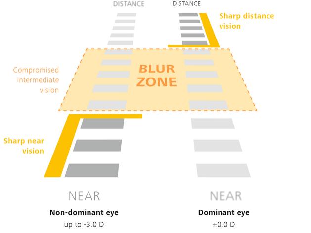 Graphic illustration of the Vision Range: Monovision