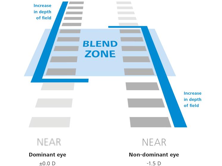 Ilustração gráfica da amplitude de visão: Laser Blended Vision