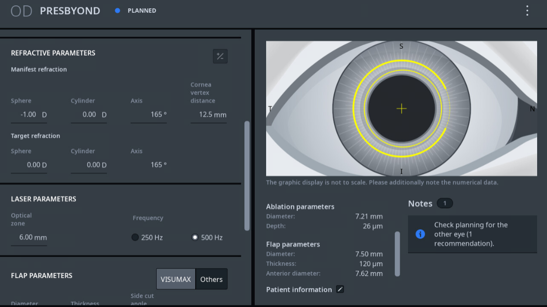 Image pour Prise en charge de la presbytie avec ZEISS : Planifier