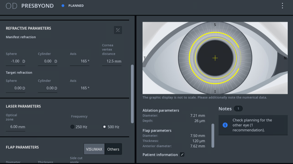 Imagen de Tratamiento de la presbicia de ZEISS: Planificación