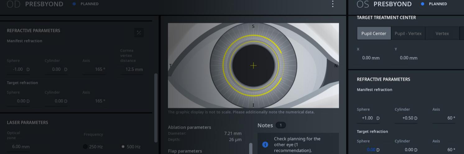 Illustration of ZEISS Presbyopia Management: Plan, view of the software