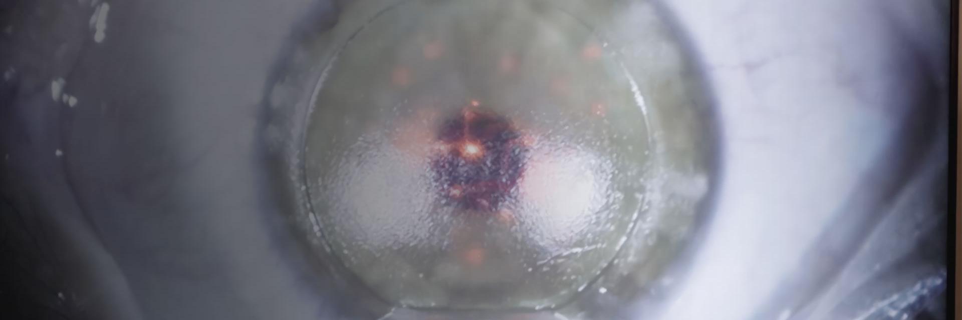 Image d'un œil, illustration pour Prise en charge de la presbytie avec ZEISS : Traiter