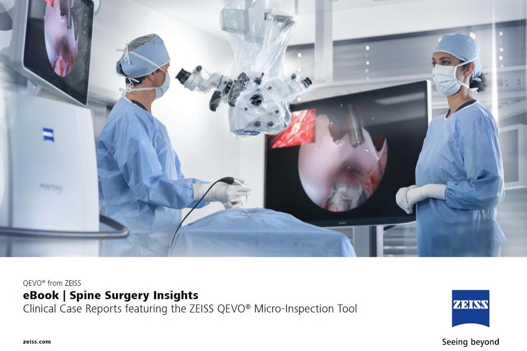 Medical professionals operate advanced surgical equipment with visual assistance from ZEISS QEVO® during a procedure in a modern operating room.