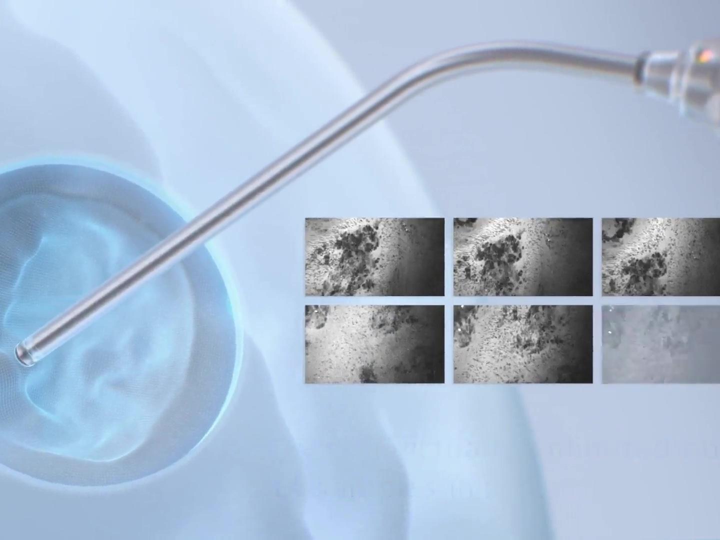 In situ visualization on microscopic level