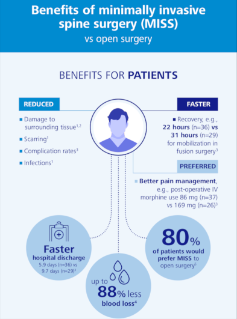 Image d’aperçu de Benefits of minimally invasive spine surgery (MISS)