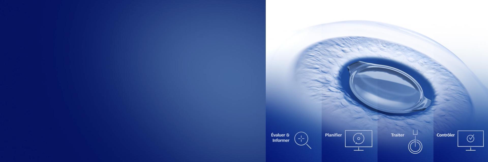 ZEISS Premium Cataract Workflow