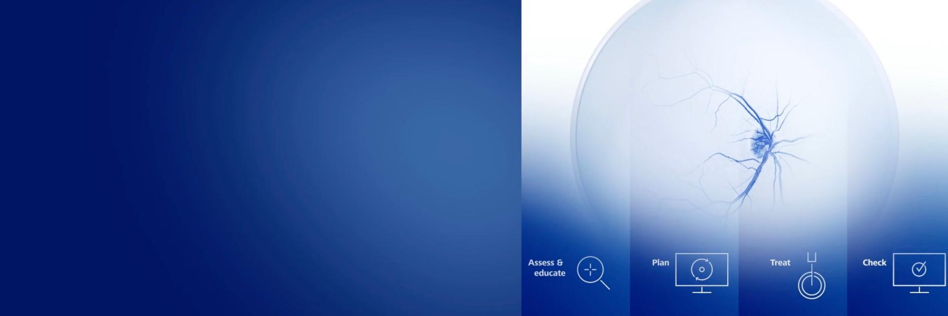ZEISS Glaucoma Workflow