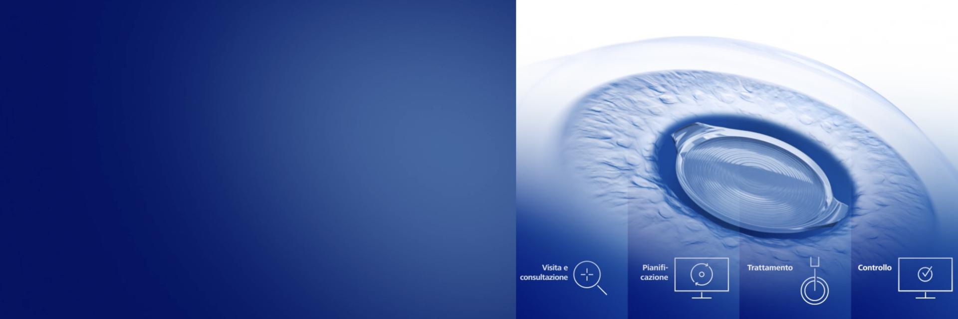 ZEISS Premium Cataract Workflow