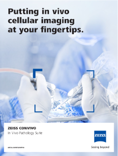 Preview image of ZEISS CONVIVO brochure