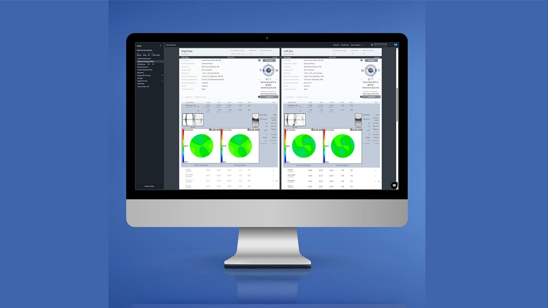 A computer monitor displaying ZEISS VERACITY Surgery Planner with dual eye analysis charts and data visualizations on a blue background.