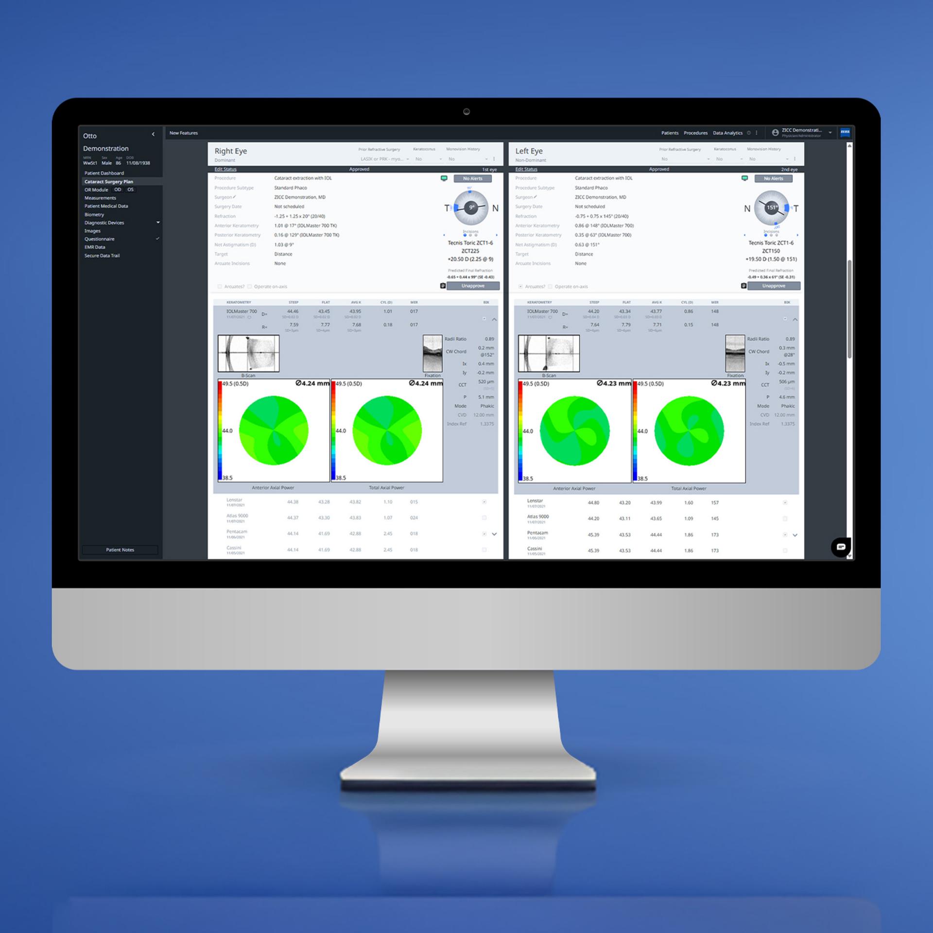Image of ZEISS VERACITY Surgery Planner